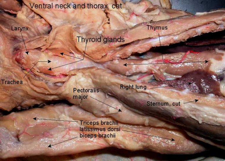 Anatomy: The Thymus Gland – Wise Mindbody Healing